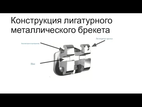 Конструкция лигатурного металлического брекета Подлигатурное пространство Паз Лигатурные крылья