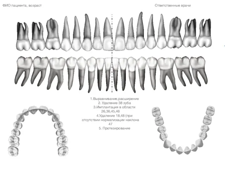 1.Выравнивание,расширение 2. Удаление 38 зуба 3.Имплантация в области 26,36,45,46 4.Удаление
