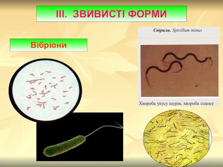 Вібріони ІІІ. ЗВИВИСТІ ФОРМИ