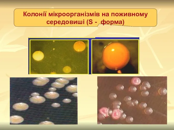 Колонії мікроорганізмів на поживному середовиші (S - форма)