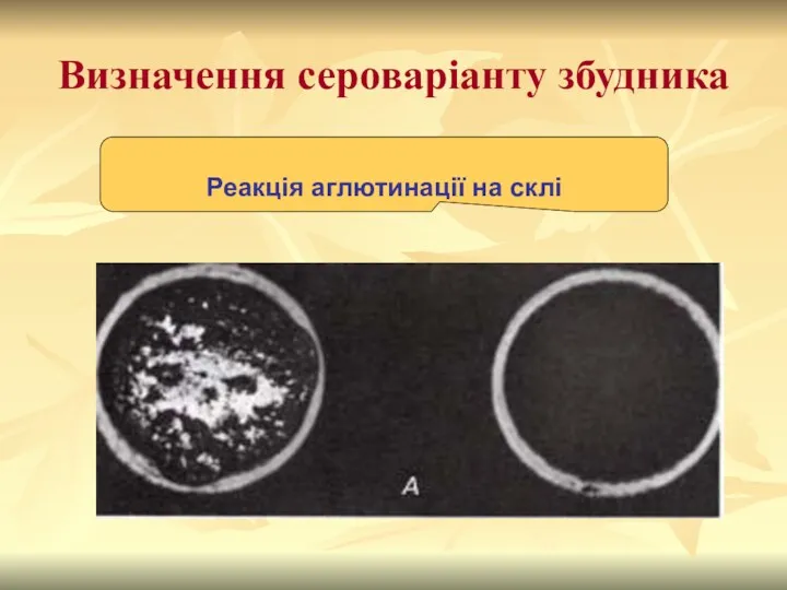 Визначення сероваріанту збудника Реакція аглютинації на склі