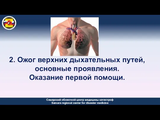 2. Ожог верхних дыхательных путей, основные проявления. Оказание первой помощи.