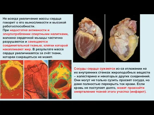 Не всегда увеличение массы сердца говорит о его выносливости и