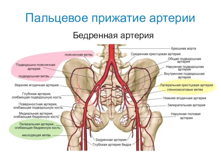 Пальцевое прижатие артерии Бедренная артерия