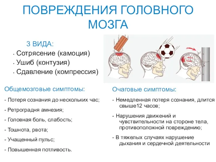 ПОВРЕЖДЕНИЯ ГОЛОВНОГО МОЗГА 3 ВИДА: Сотрясение (камоция) Ушиб (контузия) Сдавление