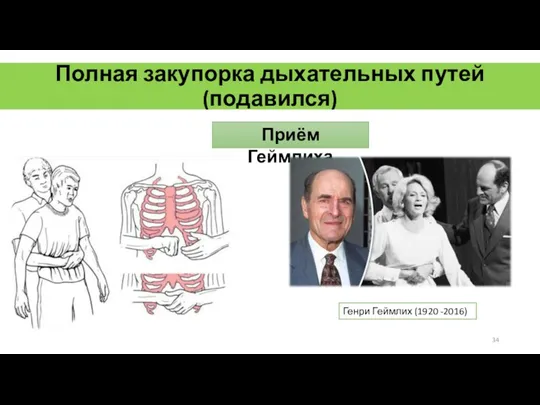 Полная закупорка дыхательных путей (подавился) Приём Геймлиха Генри Геймлих (1920 -2016)