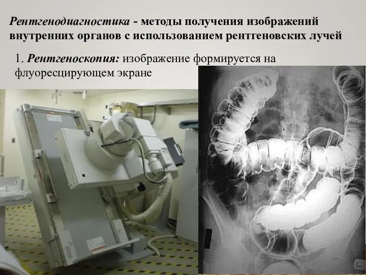 Рентгенодиагностика - методы получения изображений внутренних органов с использованием рентгеновских