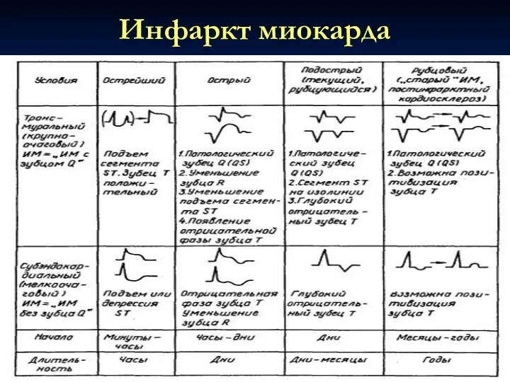 Инфаркт миокарда