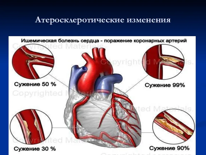 Атеросклеротические изменения