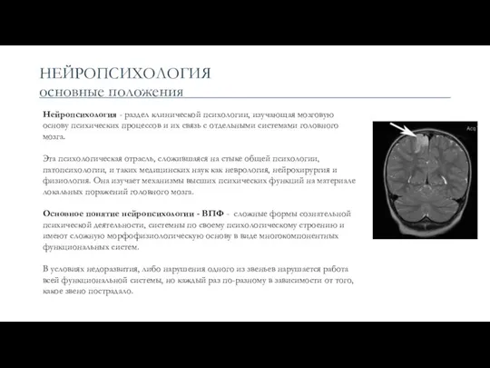 НЕЙРОПСИХОЛОГИЯ основные положения Нейропсихология - раздел клинической психологии, изучающая мозговую основу психических процессов