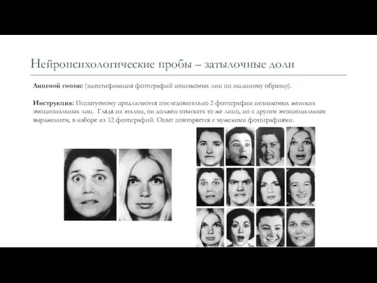 Нейропсихологические пробы – затылочные доли Лицевой гнозис (идентификация фотографий незнакомых лиц по заданному