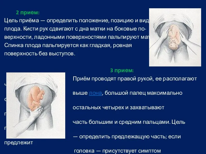 2 прием: Цель приёма — определить положение, позицию и вид