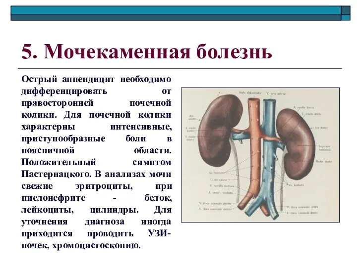 5. Мочекаменная болезнь Острый аппендицит необходимо дифференцировать от правосторонней почечной