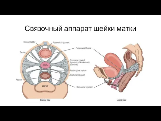 Связочный аппарат шейки матки