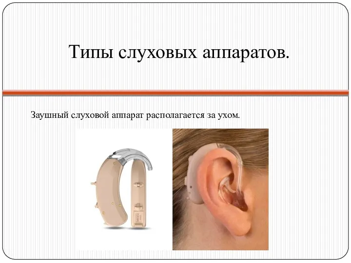 Типы слуховых аппаратов. Заушный слуховой аппарат располагается за ухом.