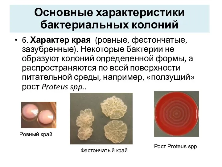 6. Характер края (ровные, фестончатые, зазубренные). Некоторые бактерии не образуют