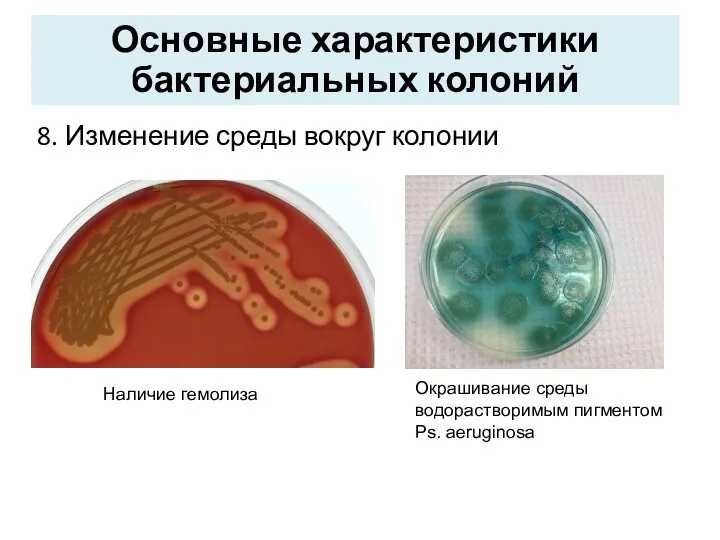 8. Изменение среды вокруг колонии Основные характеристики бактериальных колоний Наличие