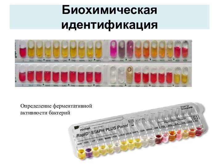 Биохимическая идентификация Определение ферментативной активности бактерий