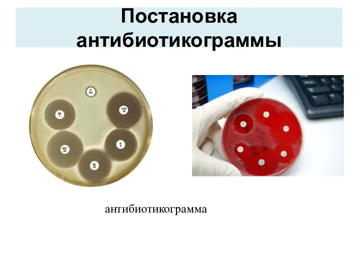 Постановка антибиотикограммы антибиотикограмма