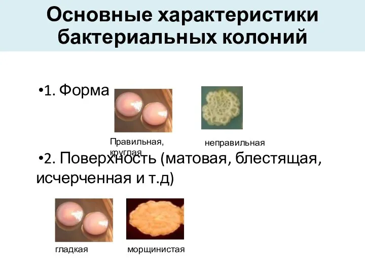 Основные характеристики бактериальных колоний 1. Форма 2. Поверхность (матовая, блестящая,