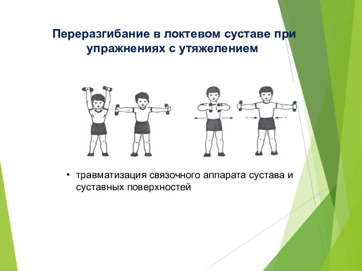 Переразгибание в локтевом суставе при упражнениях с утяжелением травматизация связочного аппарата сустава и суставных поверхностей