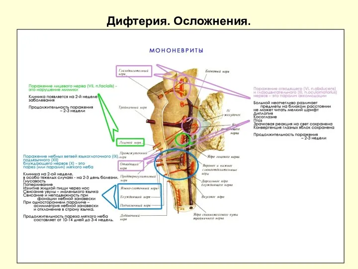 Дифтерия. Осложнения.