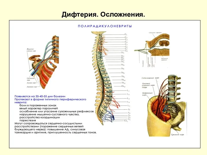 Дифтерия. Осложнения.