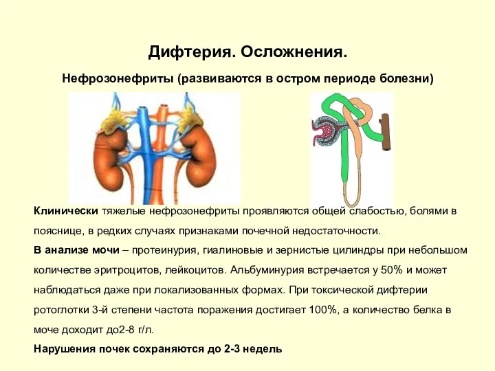 Дифтерия. Осложнения. Нефрозонефриты (развиваются в остром периоде болезни) Клинически тяжелые