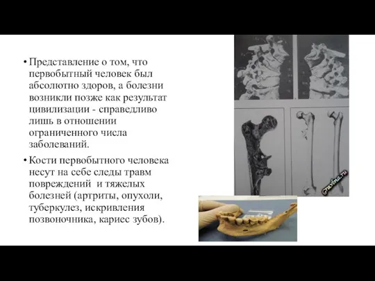 Представление о том, что первобытный человек был абсолютно здоров, а болезни возникли позже