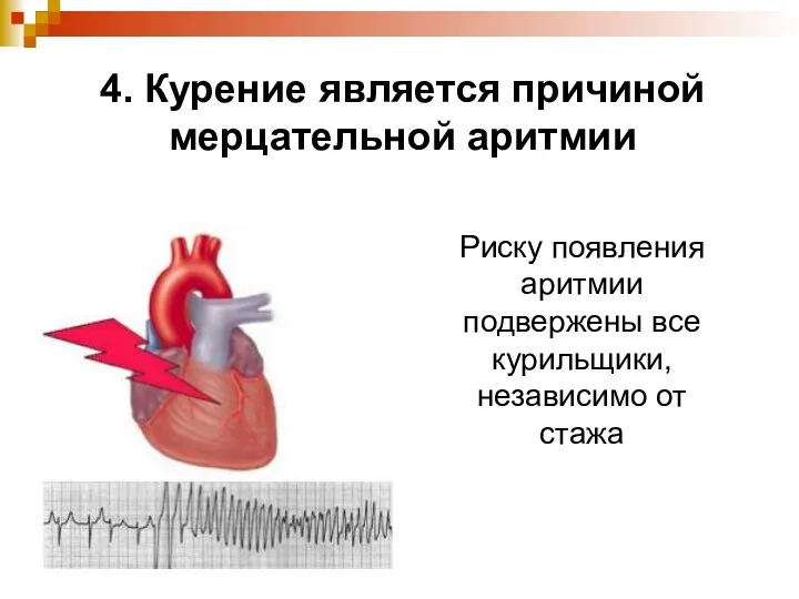 Риску появления аритмии подвержены все курильщики, независимо от стажа 4. Курение является причиной мерцательной аритмии