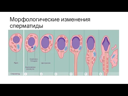 Морфологические изменения сперматиды