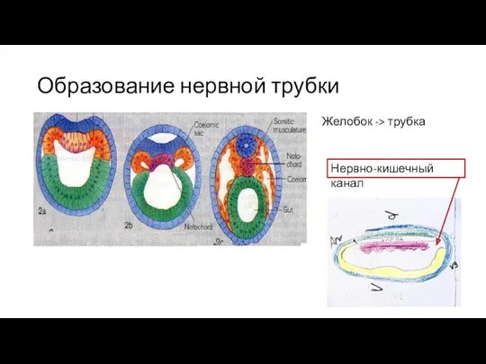 Образование нервной трубки Желобок -> трубка Нервно-кишечный канал