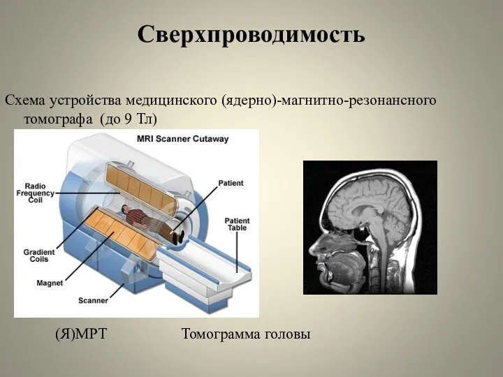 Сверхпроводимость Схема устройства медицинского (ядерно)-магнитно-резонансного томографа (до 9 Тл) (Я)МРТ Томограмма головы