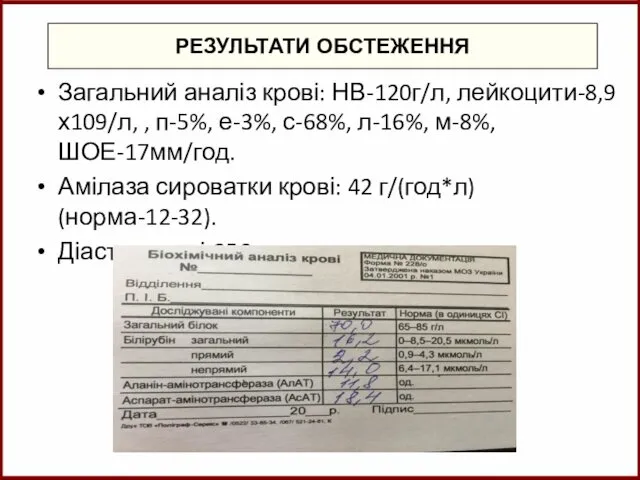 РЕЗУЛЬТАТИ ОБСТЕЖЕННЯ Загальний аналіз крові: НВ-120г/л, лейкоцити-8,9х109/л, , п-5%, е-3%,