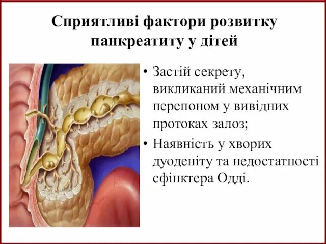 Сприятливі фактори розвитку панкреатиту у дітей Застій секрету, викликаний механічним