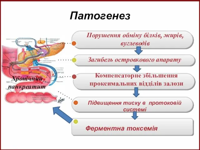 Патогенез Порушення обміну білків, жирів,вуглеводів Загибель островкового апарату Компенсаторне збільшення