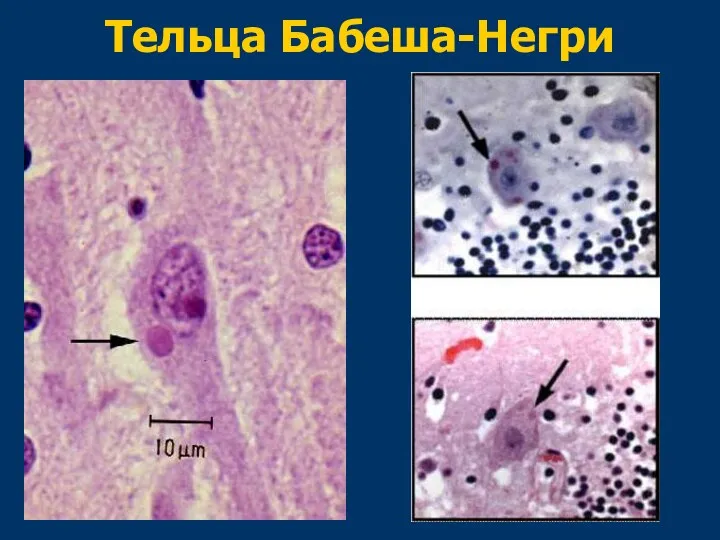 Тельца Бабеша-Негри