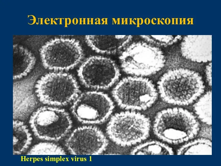 Электронная микроскопия Herpes simplex virus 1