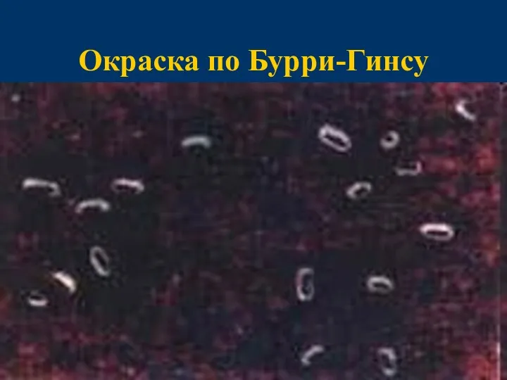 Окраска по Бурри-Гинсу