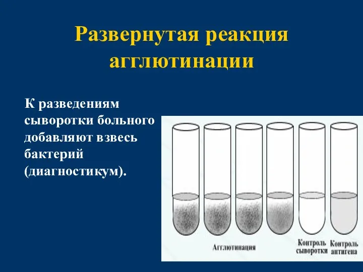 Развернутая реакция агглютинации К разведениям сыворотки больного добавляют взвесь бактерий (диагностикум).