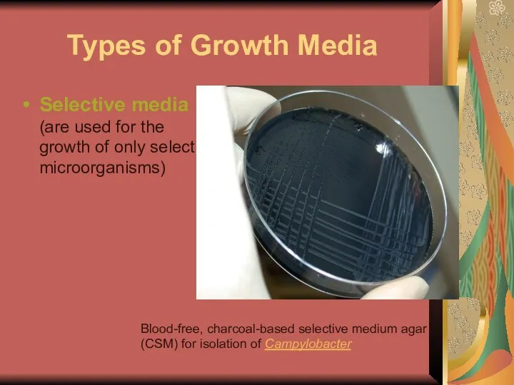 Types of Growth Media Selective media (are used for the