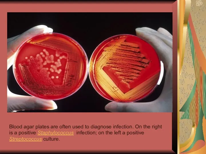 Blood agar plates are often used to diagnose infection. On