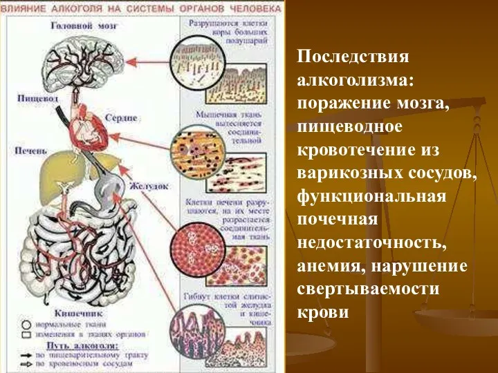 Последствия алкоголизма: поражение мозга, пищеводное кровотечение из варикозных сосудов, функциональная почечная недостаточность, анемия, нарушение свертываемости крови