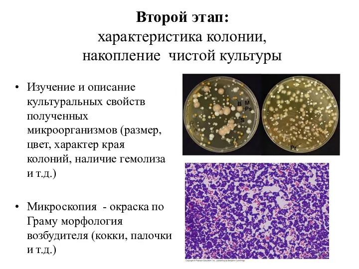 Второй этап: характеристика колонии, накопление чистой культуры Изучение и описание