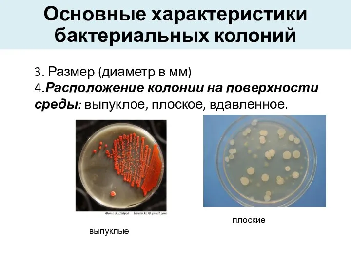 Основные характеристики бактериальных колоний 3. Размер (диаметр в мм) 4.Расположение