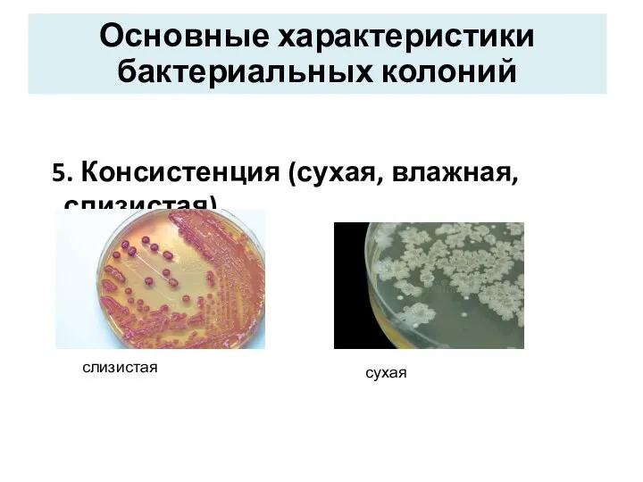 Основные характеристики бактериальных колоний 5. Консистенция (сухая, влажная, слизистая) слизистая сухая