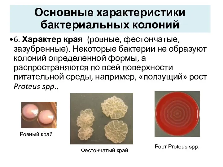 6. Характер края (ровные, фестончатые, зазубренные). Некоторые бактерии не образуют