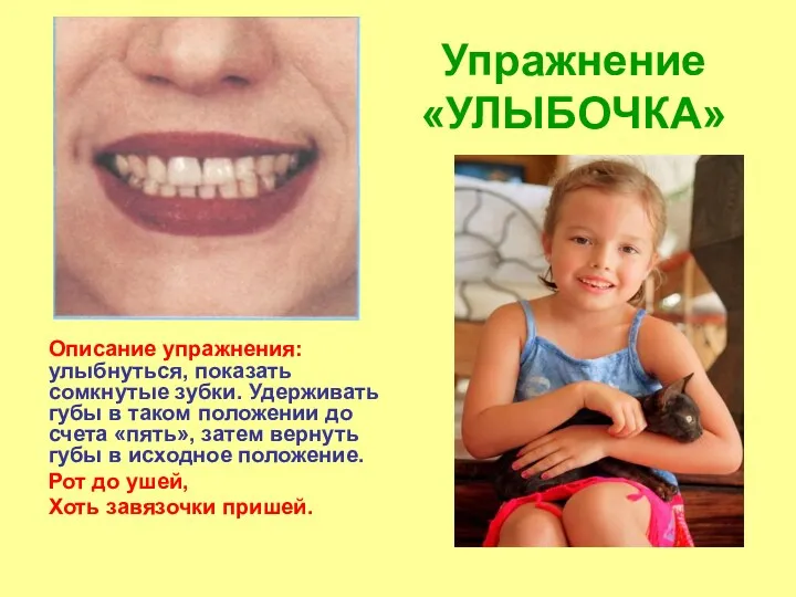 Упражнение «УЛЫБОЧКА» Описание упражнения: улыбнуться, показать сомкнутые зубки. Удерживать губы