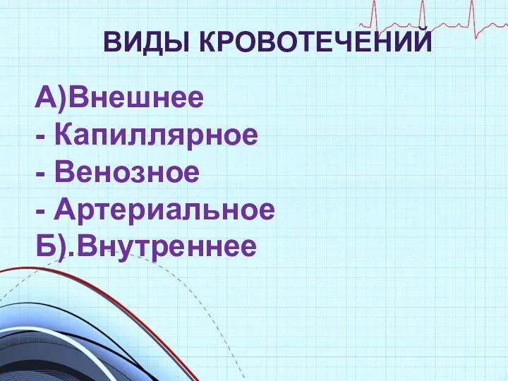 ВИДЫ КРОВОТЕЧЕНИЙ А)Внешнее - Капиллярное - Венозное - Артериальное Б).Внутреннее