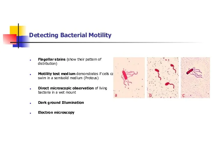 Detecting Bacterial Motility Flagellar stains (show their pattern of distribution) Motility test medium